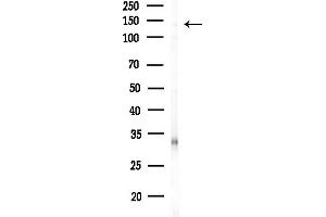 anti-Kinesin Family Member 4B (KIF4B) (C-Term) antibody