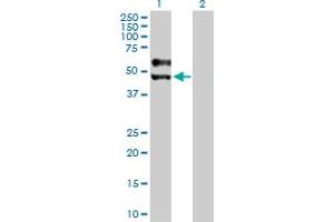 Western Blot analysis of SIGIRR expression in transfected 293T cell line by SIGIRR MaxPab polyclonal antibody. (SIGIRR anticorps  (AA 1-410))