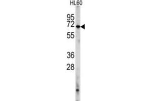 Western Blotting (WB) image for anti-phosphodiesterase 8A (PDE8A) antibody (ABIN2998130) (PDE8A anticorps)