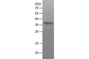 Western Blotting (WB) image for CD8a Molecule (CD8A) (AA 22-182) protein (His-IF2DI Tag) (ABIN7122217)
