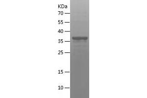Western Blotting (WB) image for CD8a Molecule (CD8A) (AA 22-182) protein (His-IF2DI Tag) (ABIN7122217) (CD8 alpha Protein (AA 22-182) (His-IF2DI Tag))