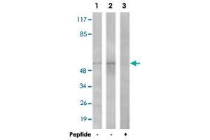 Western blot analysis of extracts from COLO cells (Lane 1) and HepG2 cells (Lane 2 and 3), using TGFBR1 polyclonal antibody . (TGFBR1 anticorps  (Ser165))