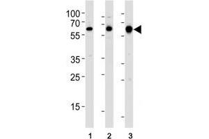 Western blot analysis of lysate from (1) human MCF-7, (2) rat PC-12, and (3) mouse C2C12 cell line using c-Src antibody at 1:1000.