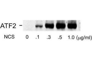 Image no. 1 for anti-Activating Transcription Factor 2 (ATF2) (pSer490), (pSer498) antibody (ABIN372591) (ATF2 anticorps  (pSer490, pSer498))
