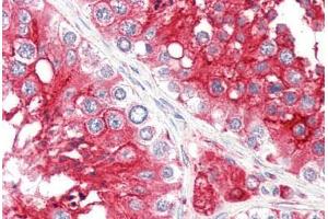 Human Testis (formalin-fixed, paraffin-embedded) stained with ACE2 antibody ABIN461888 at 2. (ACE2 anticorps  (Internal Region))