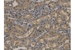 Detection of APOB in Rat Kidney Tissue using Polyclonal Antibody to Apolipoprotein B (APOB)