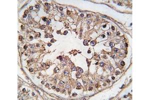 IHC analysis of FFPE human testis tissue stained with TBK antibody (TBK1 anticorps  (AA 150-181))
