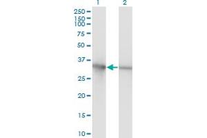 Western Blot analysis of PCNA expression in transfected 293T cell line by PCNA monoclonal antibody (M02), clone 1G7. (PCNA anticorps  (AA 1-261))