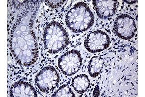 Image no. 8 for anti-Nibrin (NBN) (AA 183-460) antibody (ABIN1491059)