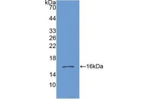 Western blot analysis of recombinant Human GDF6. (GDF6 anticorps  (AA 336-455))