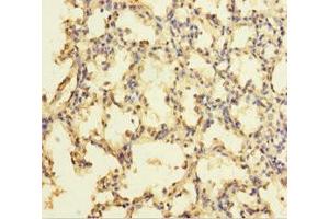 Immunohistochemistry of paraffin-embedded human lung tissue using ABIN7176105 at dilution of 1:100 (ZNF114 anticorps  (AA 1-414))