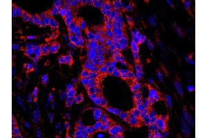 Immunofluorescence (IF) image for anti-Ubiquitin Specific Peptidase 3 (USP3) (AA 471-521) antibody (ABIN7449030) (USP3 anticorps  (AA 471-521))