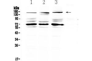 Western blot analysis of IL17RA using anti-IL17RA antibody .