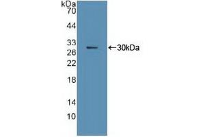Western blot analysis of recombinant Human Ki67P. (Ki-67 anticorps  (AA 3088-3235))