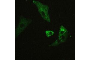 IHC analysis of CD147/Emmprin using anti-CD147/Emmprin antibody .