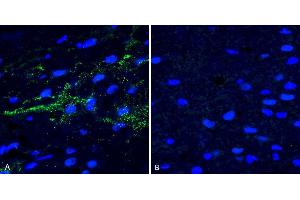 Immunohistochemistry analysis using Rabbit Anti-Alpha Synuclein (pSer129) Polyclonal Antibody (ABIN5650952). (SNCA anticorps  (pSer129) (PE))