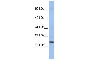 SNRPD2 antibody used at 1 ug/ml to detect target protein. (SNRPD2 anticorps  (Middle Region))