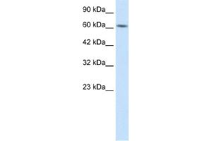 WB Suggested Anti-BTBD5 Antibody Titration:  1. (KLHL28 anticorps  (Middle Region))