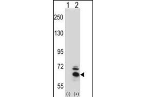 Western blot analysis of BBS4 (arrow) using rabbit polyclonal BBS4 Antibody (Center) (ABIN391811 and ABIN2841661).