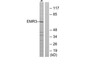 Western blot analysis of extracts from Jurkat cells, using EMR3 antibody. (EMR3 anticorps  (C-Term))