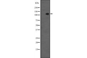 Western blot analysis of SYCP1 expression in MCF7 whole cell lysate ,The lane on the left is treated with the antigen-specific peptide. (SYCP1 anticorps  (C-Term))