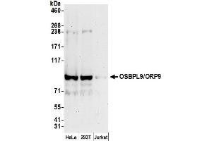 anti-Oxysterol Binding Protein-Like 9 (OSBPL9) (AA 250-300) antibody