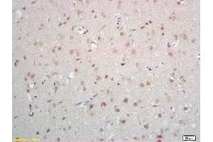Formalin-fixed and paraffin embedded rat brain labeled with Anti-ZNF423/OAZ Polyclonal Antibody, Unconjugated (ABIN1385826) at 1:200 followed by conjugation to the secondary antibody and DAB staining (Znf423 anticorps  (AA 901-1000))