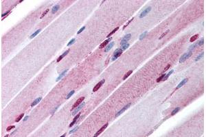 Human Skeletal Muscle (formalin-fixed, paraffin-embedded) stained with SALL4 antibody ABIN213956 at 5-10 ug/ml followed by biotinylated goat anti-rabbit IgG secondary antibody ABIN481713, alkaline phosphatase-streptavidin and chromogen. (SALL4 anticorps  (AA 28-42))