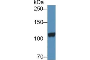 Detection of DPP6 in Porcine Cerebrum lysate using Polyclonal Antibody to Dipeptidyl Peptidase 6 (DPP6) (DPP6 anticorps  (AA 667-865))