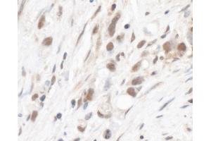Immunohistochemistry (IHC) image for anti-Ribosomal Protein L5 (RPL5) (AA 247-297) antibody (ABIN7454984)