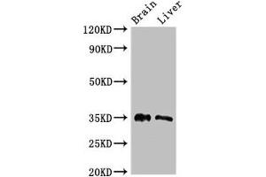 Western Blot Positive WB detected in: Mouse brain tissue, Rat liver tissue All lanes: PTF1A antibody at 2.