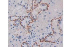 Used in DAB staining on fromalin fixed paraffin- embedded kidney tissue