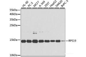 Western blot analysis of extracts of various cell lines using RPS19 Polyclonal Antibody at dilution of 1:1000. (RPS19 anticorps)
