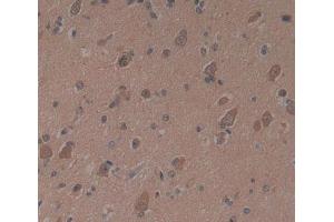 Used in DAB staining on fromalin fixed paraffin- embedded brain tissue (PSMB9 anticorps)