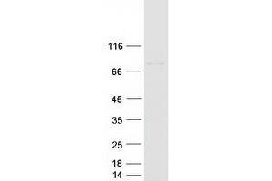 Validation with Western Blot
