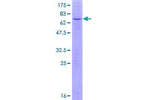 Image no. 1 for Phospholipase B (PLB) (AA 1-423) protein (GST tag) (ABIN1315320)