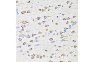 Immunohistochemistry of paraffin-embedded rat brain using COPB2 antibody. (COPB2 anticorps  (AA 657-906))