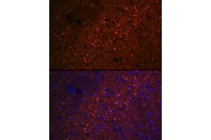 anti-Cell Cycle Exit and Neuronal Differentiation 1 (CEND1) antibody