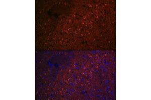 Immunofluorescence analysis of rat brain cells using CEND1 Rabbit mAb (ABIN7266242) at dilution of 1:100 (40x lens). (CEND1 anticorps)