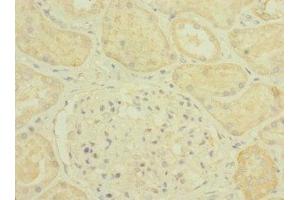 Immunohistochemistry of paraffin-embedded human kidney tissue using ABIN7163708 at dilution of 1:100 (Plexin B2 anticorps  (AA 1080-1200))
