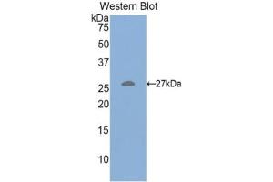 Detection of Recombinant HGF, Mouse using Polyclonal Antibody to Hepatocyte Growth Factor (HGF)