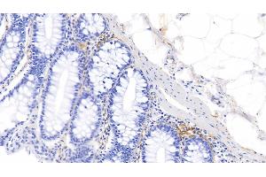 Detection of ELN in Human Colon Tissue using Polyclonal Antibody to Elastin (ELN)