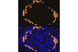 anti-Glucagon (GCG) antibody