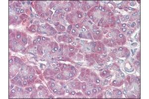 Human Pancreas (formalin-fixed, paraffin-embedded) stained with RBP1followed by biotinylated anti-goat IgG secondary antibody, alkaline phosphatase-streptavidin and chromogen. (RBP1 anticorps  (C-Term))