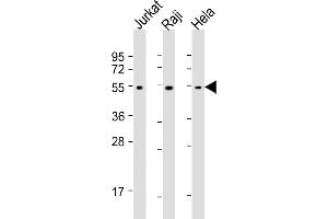 All lanes : Anti-XI Antibody at 1:1000-1:4000 dilution Lane 1: Jurkat whole cell lysates Lane 2: Raji whole cell lysates Lane 3: Hela whole cell lysates Lysates/proteins at 20 μg per lane. (XIAP anticorps)