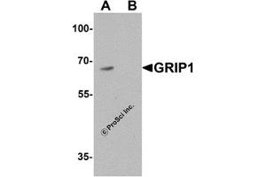 Western Blotting (WB) image for anti-Glutamate Receptor Interacting Protein 1 (GRIP1) (C-Term) antibody (ABIN1077440) (GRIP1 anticorps  (C-Term))