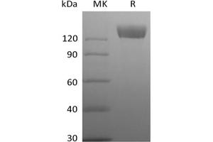 Western Blotting (WB) image for Angiotensin I Converting Enzyme 2 (ACE2) (Active) protein (Fc Tag) (ABIN7321044)