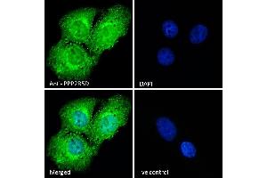 (ABIN184648) Immunofluorescence analysis of paraformaldehyde fixed U2OS cells, permeabilized with 0. (PPP2R5D anticorps  (C-Term))