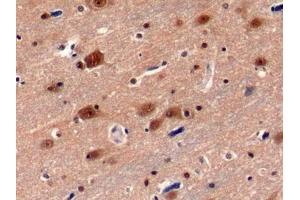 Detection of PSMC3 in Human Cerebrum Tissue using Polyclonal Antibody to Proteasome 26S Subunit, ATPase 3 (PSMC3)