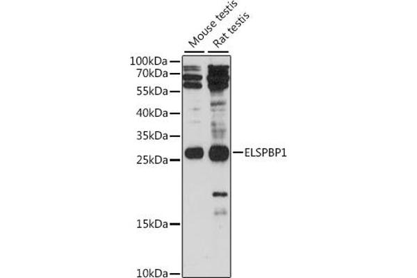 ELSPBP1 anticorps  (AA 110-223)